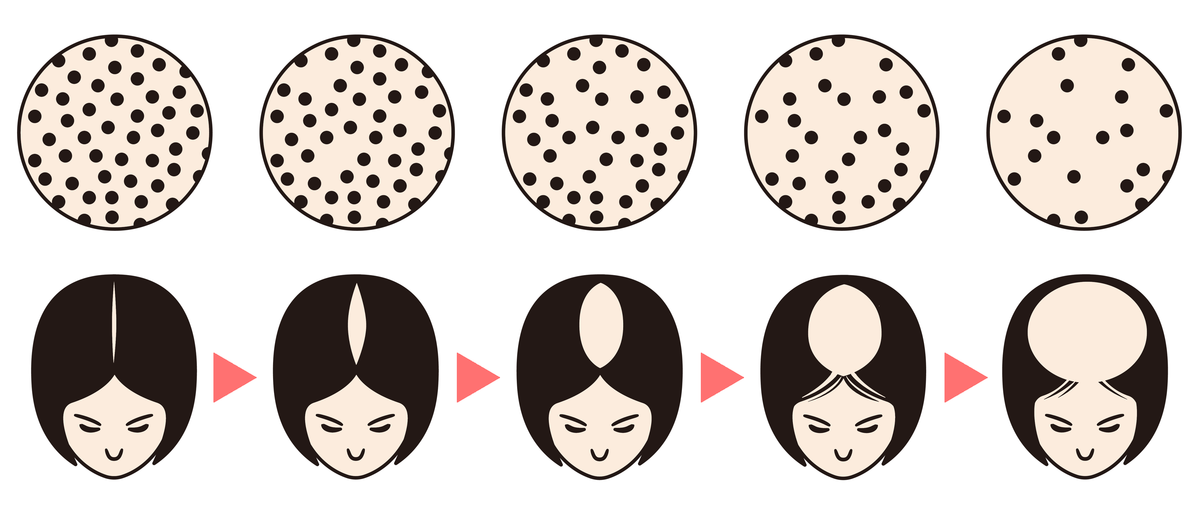 FAGA進行イメージ